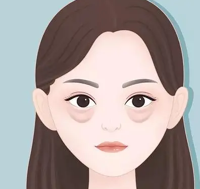眼袋