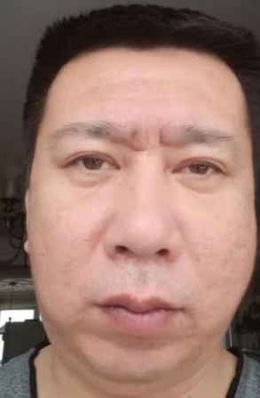 眼袋