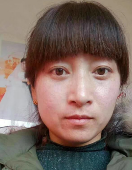 眼袋