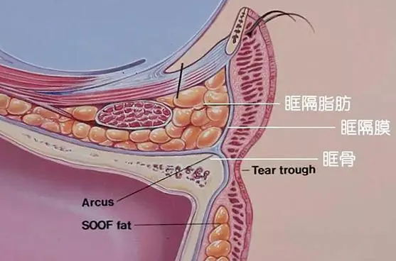 眼袋