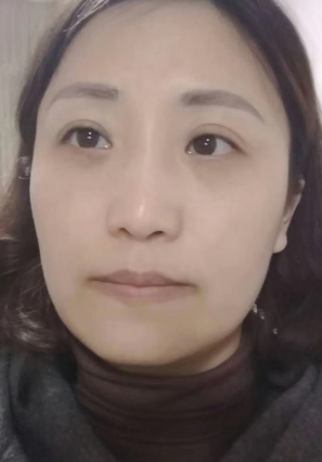 眼袋