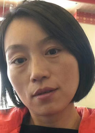 眼袋