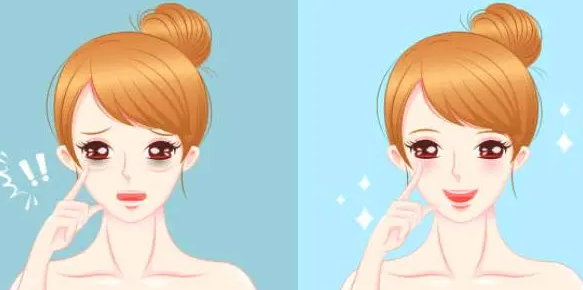 眼袋