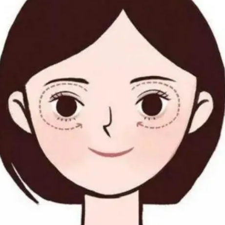 眼袋手术