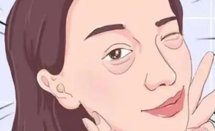 去眼袋手术