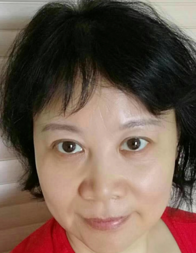 眼袋手术