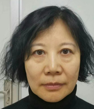眼袋手术