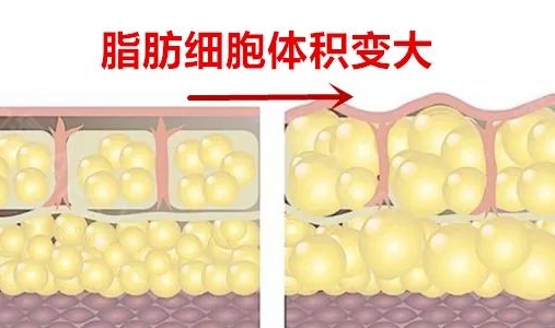 超声波减肥