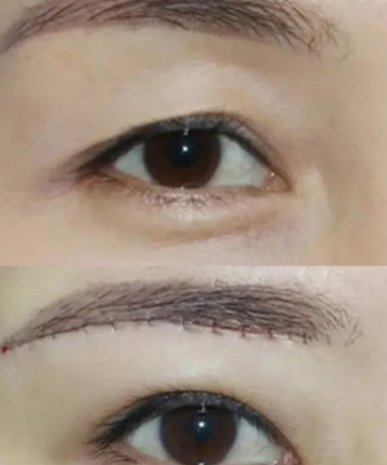 提眉