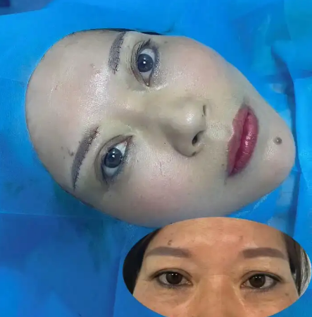提眉