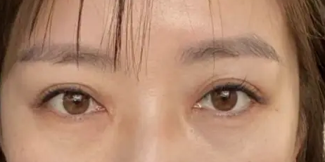 提眉