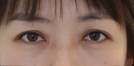 提眉