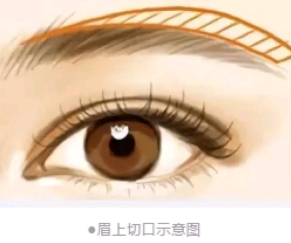提眉
