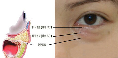 眼袋