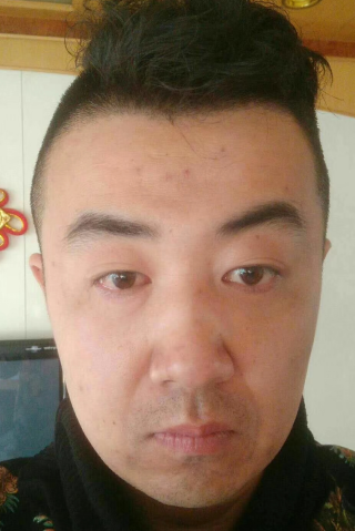 眼袋