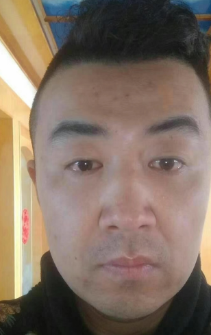 眼袋