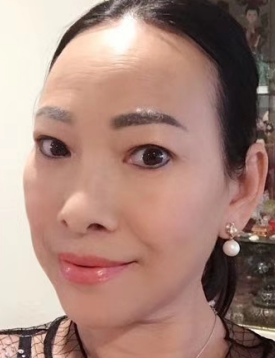 去眼袋手术