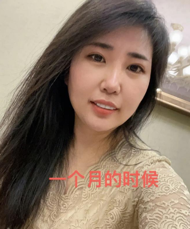 提眉