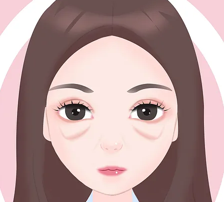 眼袋