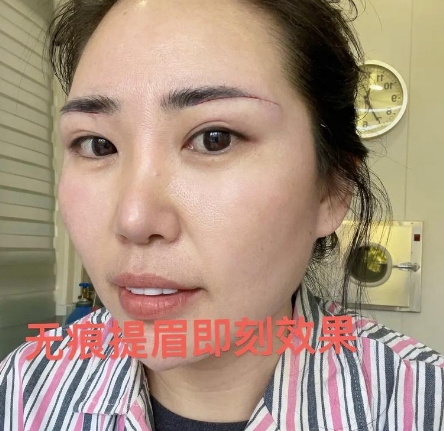 提眉
