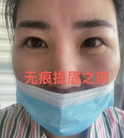 提眉