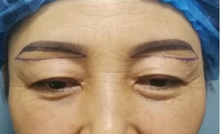 提眉