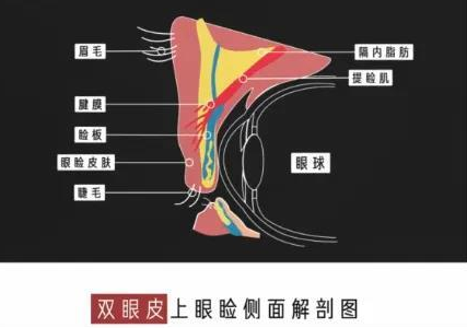 超声波双眼皮