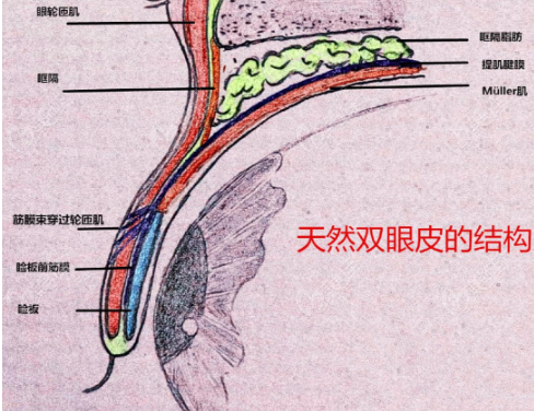超声波双眼皮