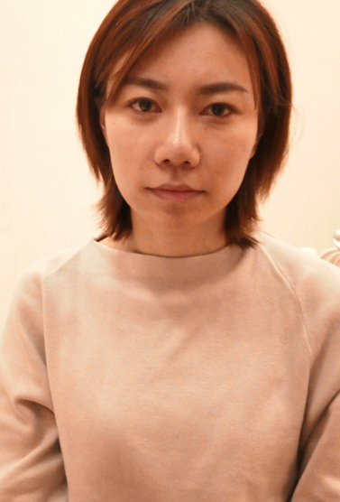 自体脂肪细胞丰胸