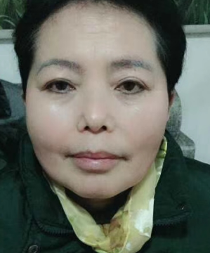 眼袋