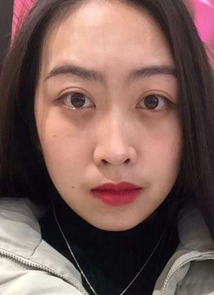 眼袋