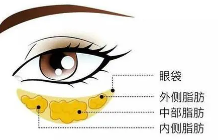 眼袋
