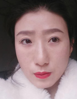 眼袋