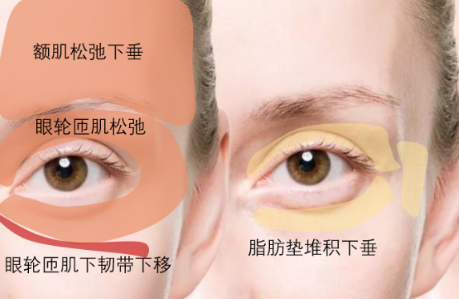 眼袋