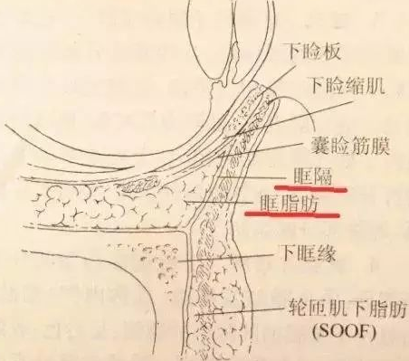 眼袋