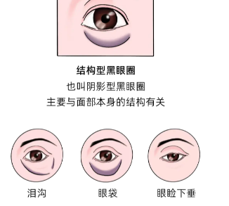 眼袋