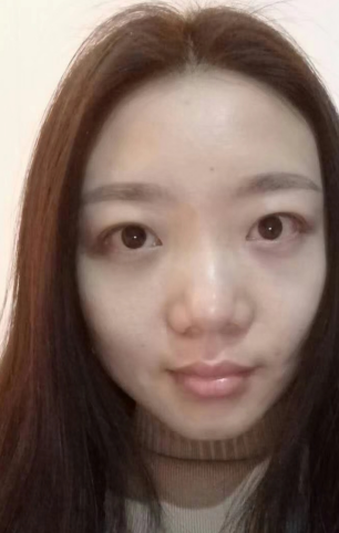 眼袋