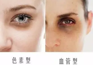 眼袋
