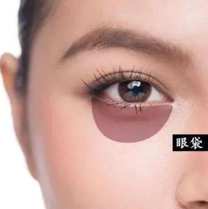 眼袋