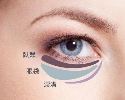 眼袋