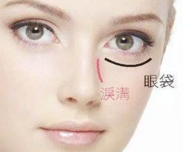 眼袋