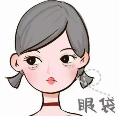 去眼袋手术