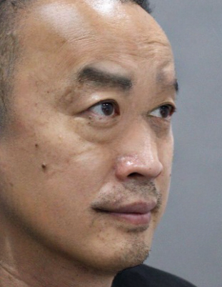 去眼袋手术