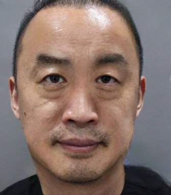 去眼袋手术