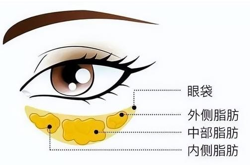 眼袋