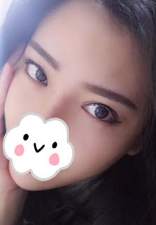 眼袋