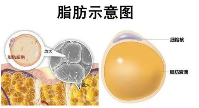 自体脂肪丰胸