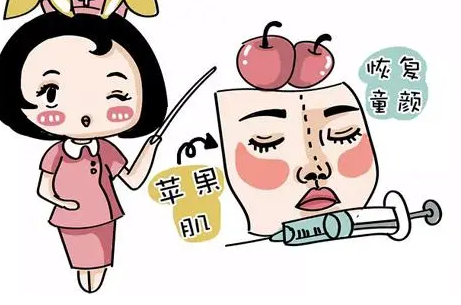 自体脂肪丰胸