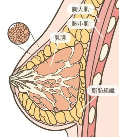 丰胸