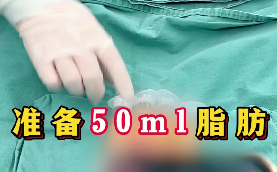 丰胸